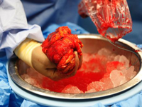 Blodigt organ som ligger i is Blodigt organ som ligger i is